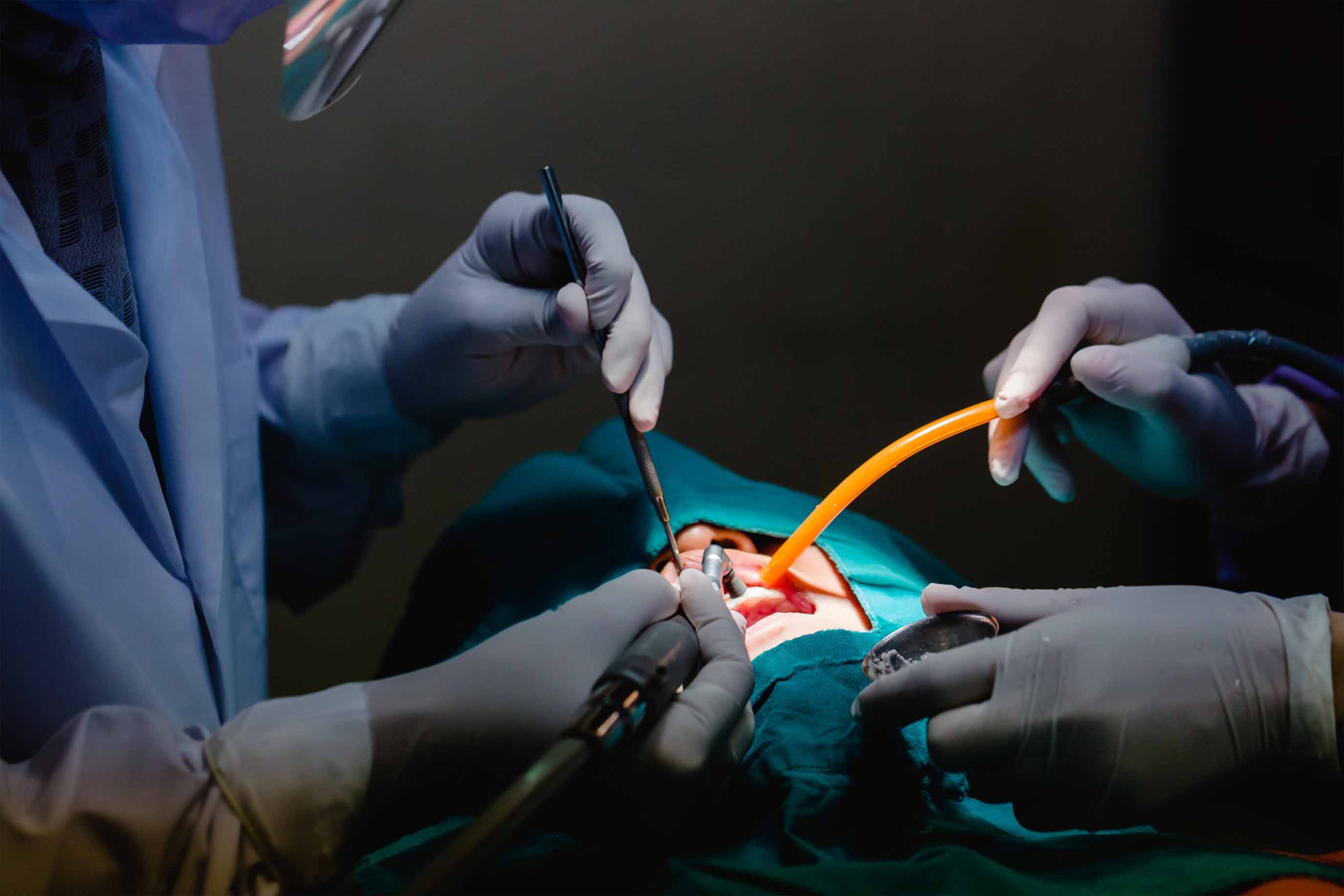 cirugia oral serveis