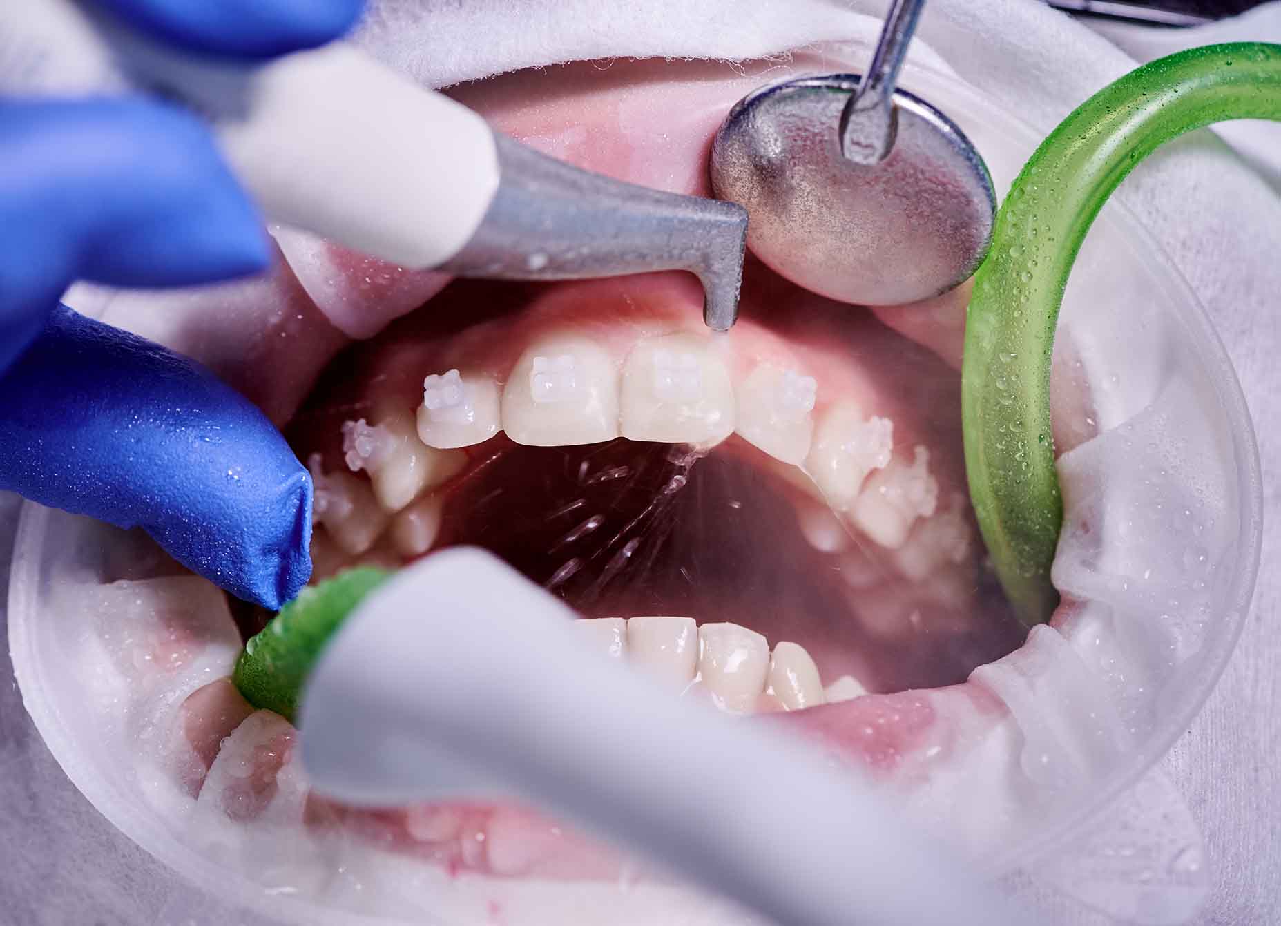 periodoncia