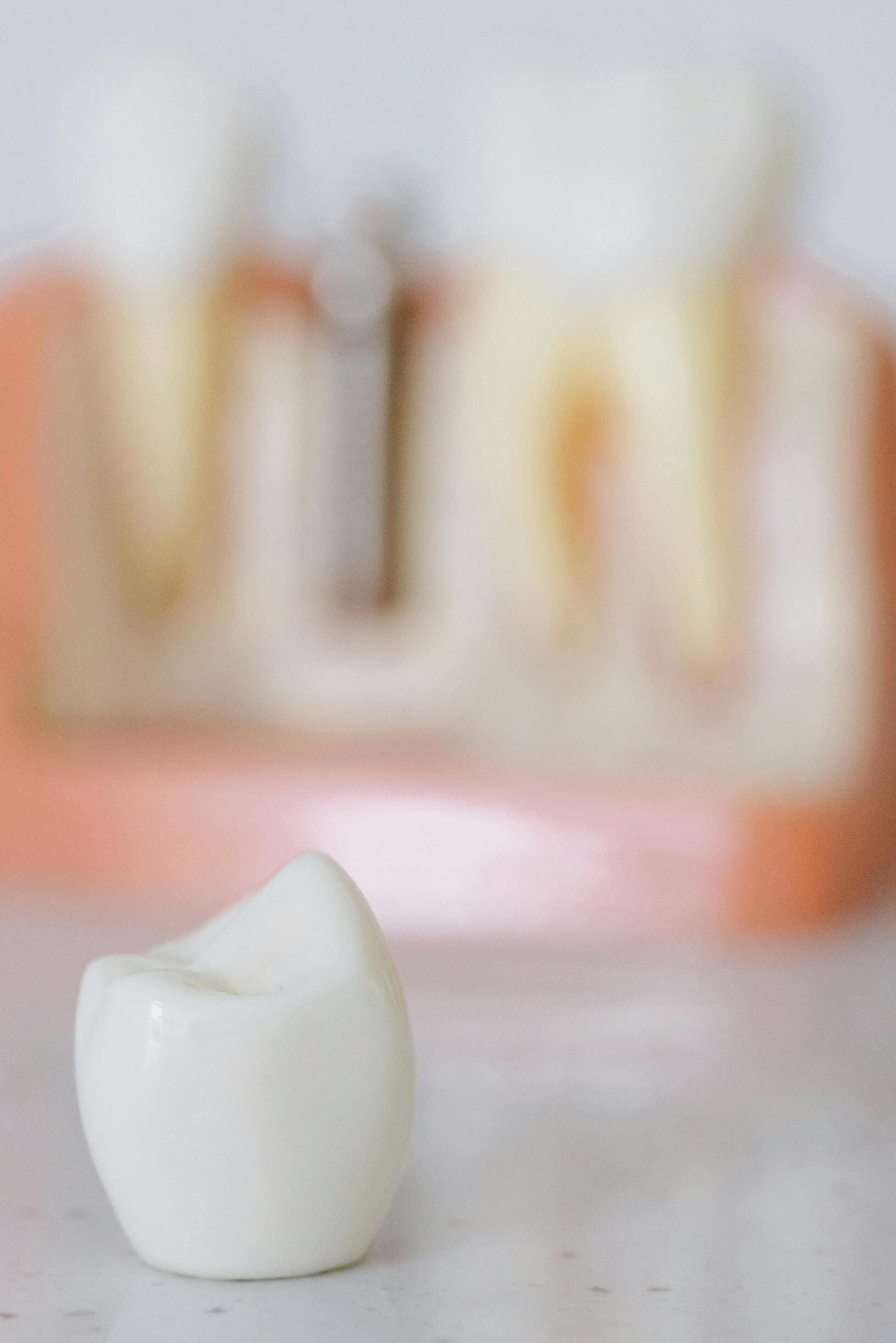 implantes dentales en sarria